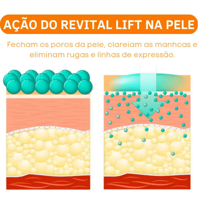 Creme Clareador Revital Lift™  | Compre 1 Leve 2 [FRETE GRÁTIS]