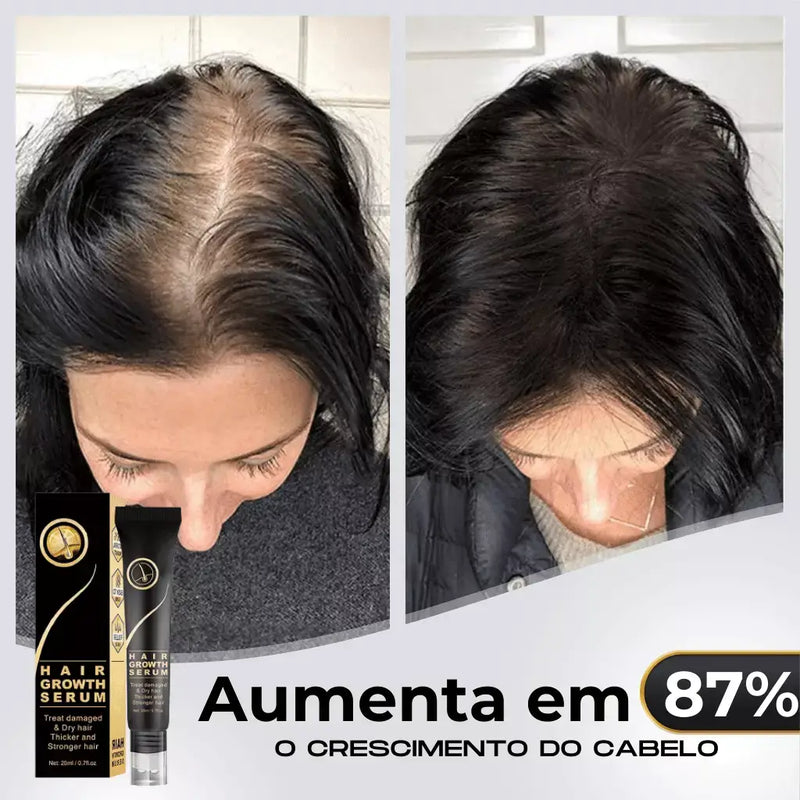 Tônico Capilar Repair Hair® | Crescimento Capilar e Combate à Queda de Cabelo | Pague 1 Leve 2