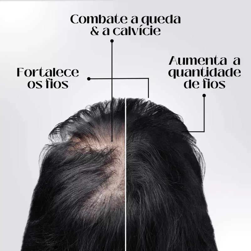 Tônico Capilar Repair Hair® | Crescimento Capilar e Combate à Queda de Cabelo | Pague 1 Leve 2