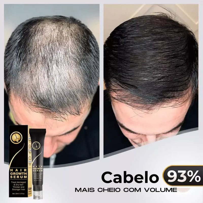 Tônico Capilar Repair Hair® | Crescimento Capilar e Combate à Queda de Cabelo | Pague 1 Leve 2