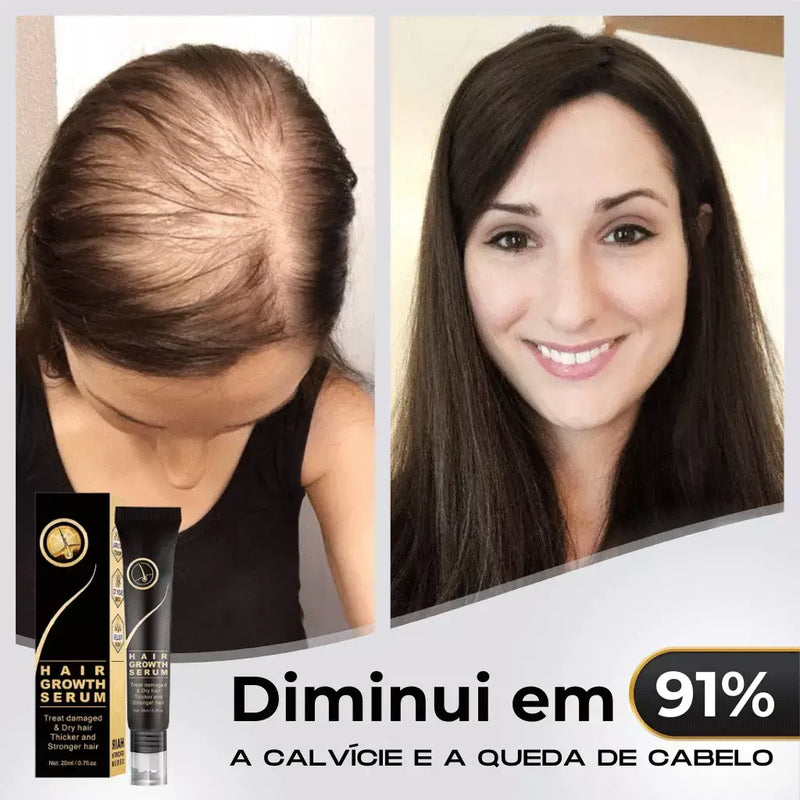 Tônico Capilar Repair Hair® | Crescimento Capilar e Combate à Queda de Cabelo | Pague 1 Leve 2