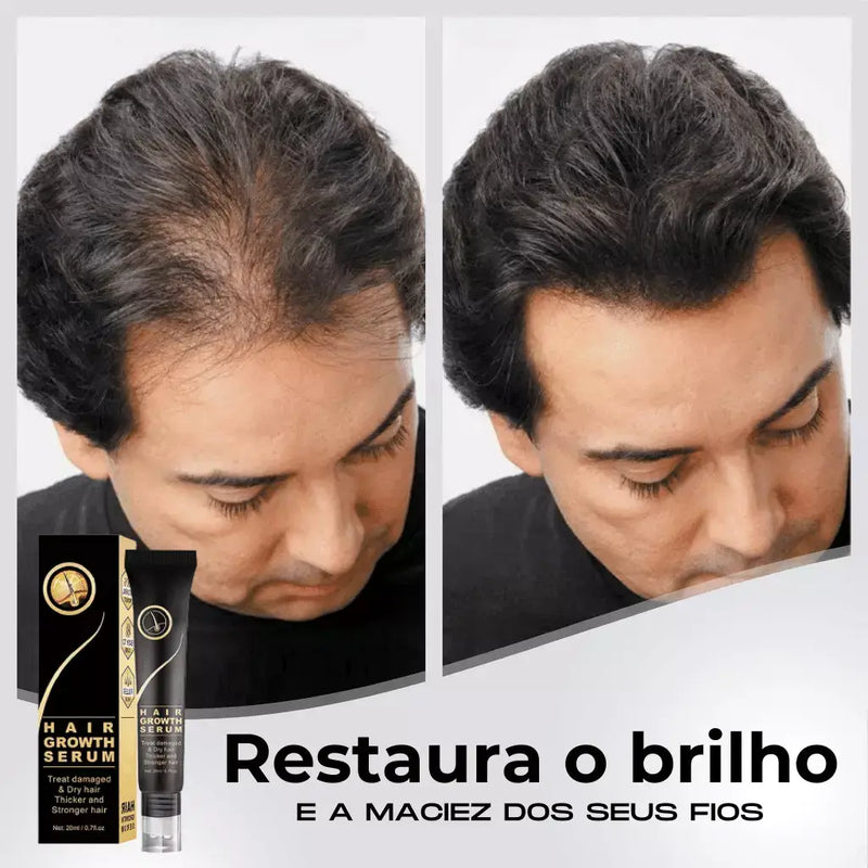 Tônico Capilar Repair Hair® | Crescimento Capilar e Combate à Queda de Cabelo | Pague 1 Leve 2